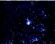 UV image of SN1987a